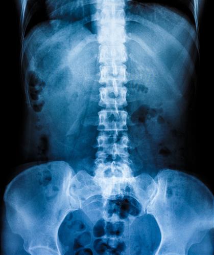 Skeleton X-Ray Picture	