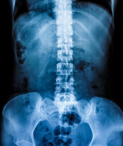 Skeleton X-Ray Picture